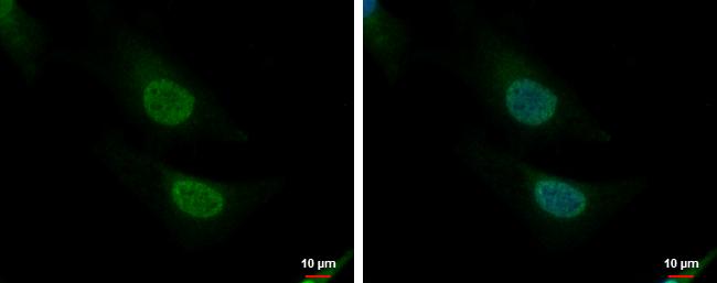 CNOT8 Antibody - BSA Free