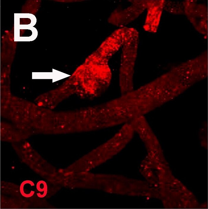 Complement Component C9 Antibody