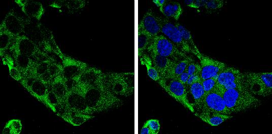 Complement Component C9 Antibody - BSA Free