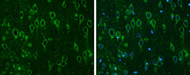 COMT Antibody - BSA Free