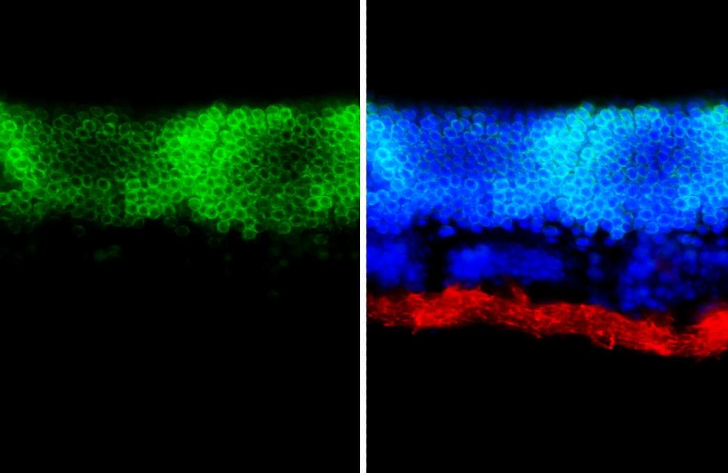 CRX/CORD2 Antibody