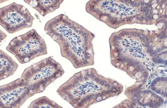 Cortactin Antibody