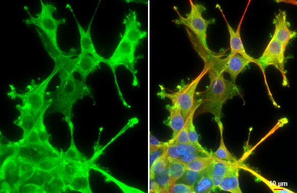 Cortactin Antibody