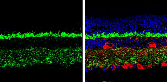 CPLX3 Antibody - BSA Free