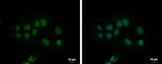 CPSF2 Antibody - BSA Free
