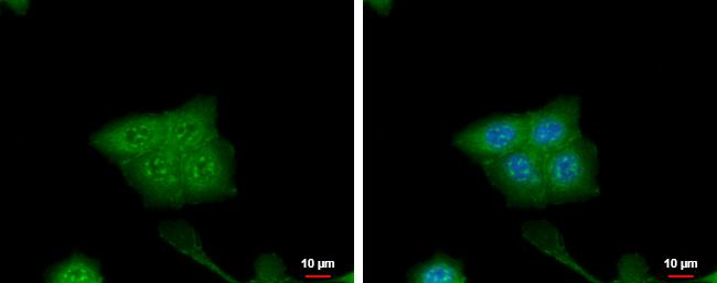 CRABP2 Antibody