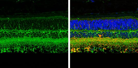CRABP2 Antibody