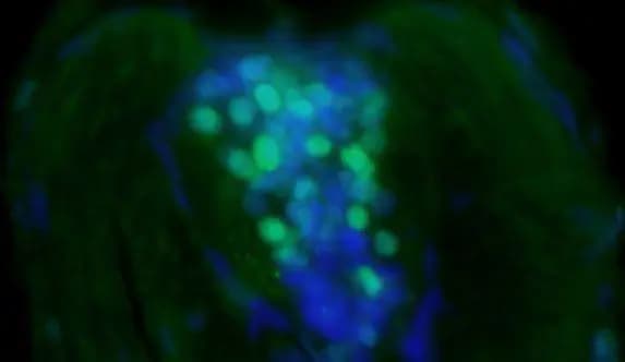 CSNK1A1L Antibody