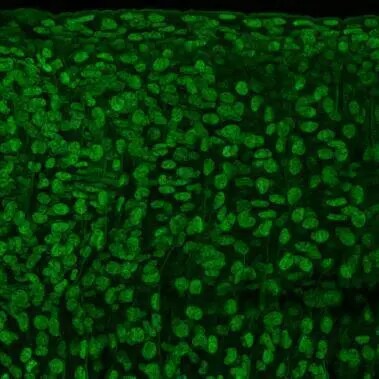 CtBP1 Antibody