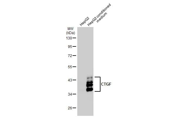 CTGF/CCN2 Antibody - BSA Free