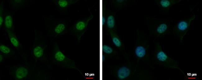CUGBP2 Antibody