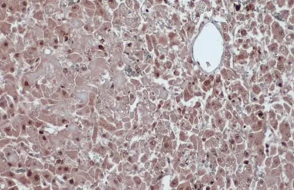 Cyclin D1 Antibody