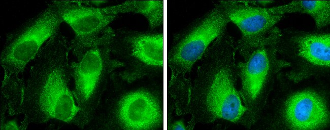 CYP3A43 Antibody