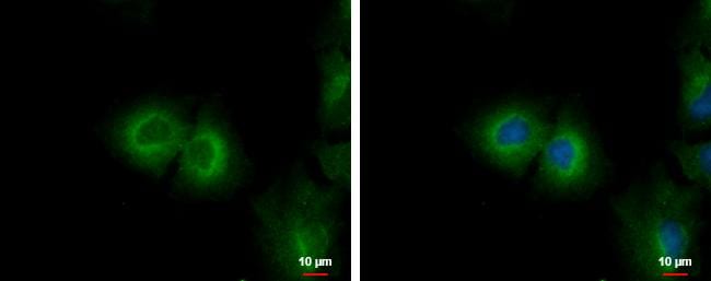 Cytochrome P450 4F11 Antibody