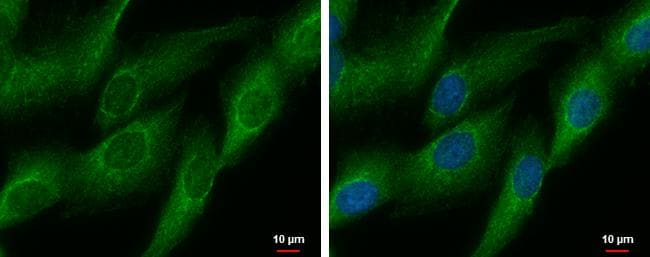 DDAH2 Antibody - BSA Free
