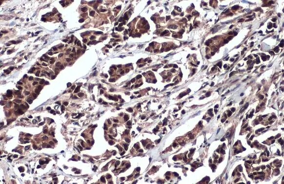 DDX3 Antibody