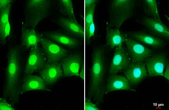 DDX3 Antibody