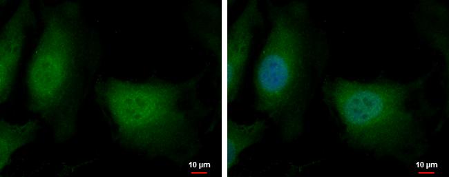 DENR Antibody