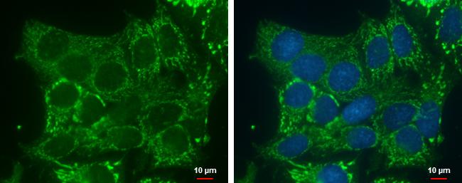 DHRS2 Antibody