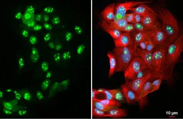 DNA Ligase IV Antibody