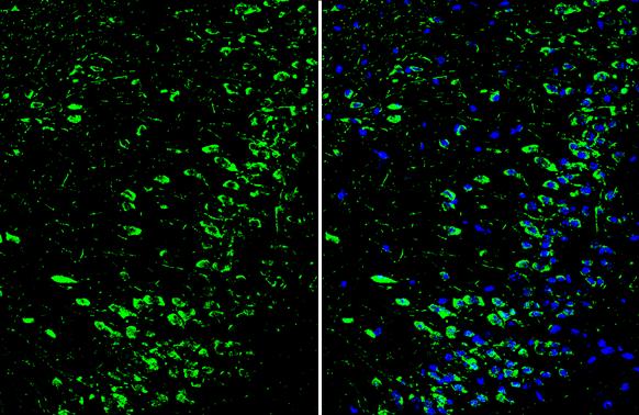 Dopamine D1R/DRD1 Antibody - BSA Free