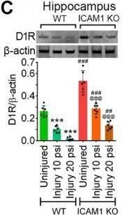 Dopamine D1R/DRD1 Antibody - BSA Free