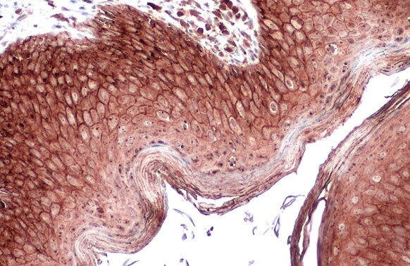 E-Cadherin Antibody