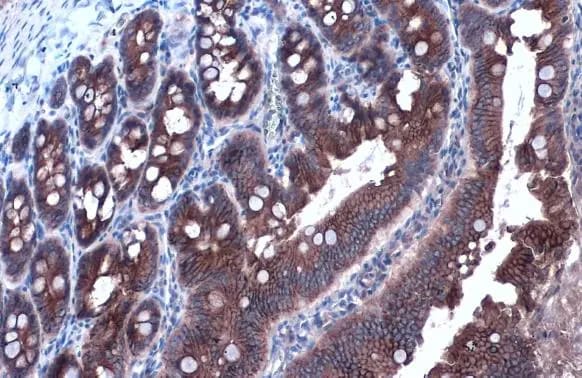 E-Cadherin Antibody