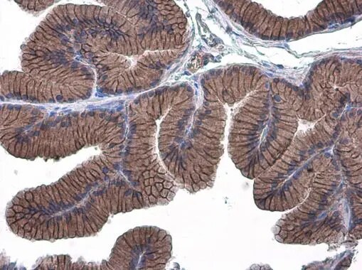 E-Cadherin Antibody