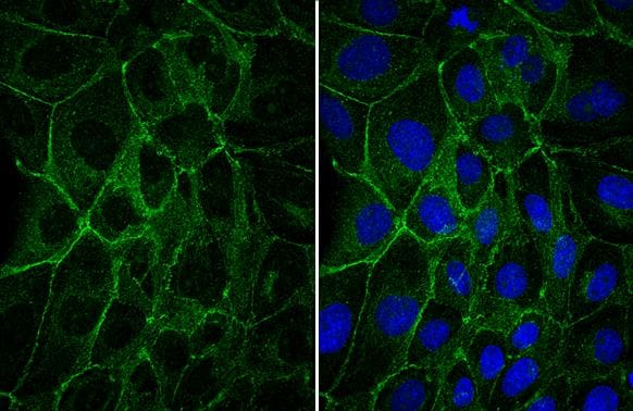 E-Cadherin Antibody