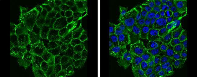 E-Cadherin Antibody