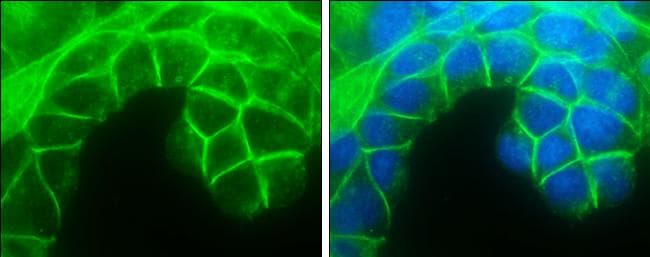 E-Cadherin Antibody