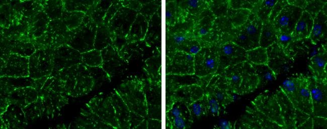 E-Cadherin Antibody