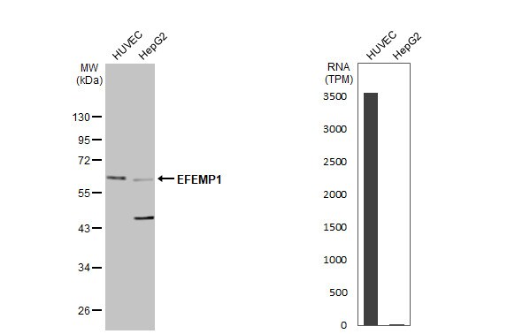 Fibulin-3/EFEMP1 Antibody