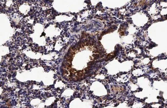 EDNRB/Endothelin R Type B Antibody - BSA Free