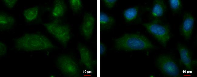 ENPP-2/Autotaxin Antibody