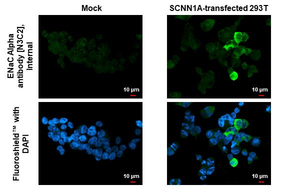 epithelial Sodium Channel alpha Antibody - BSA Free