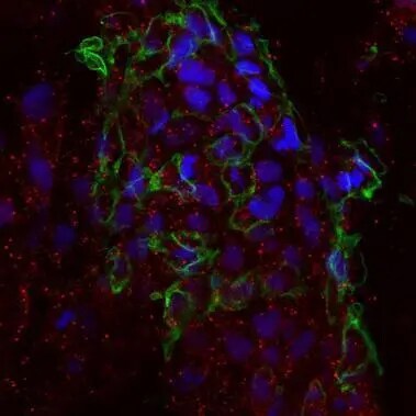 ETFA Antibody