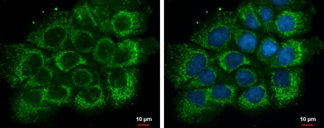 ETHE1 Antibody