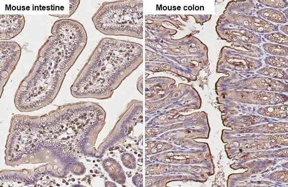 Ezrin Antibody - BSA Free