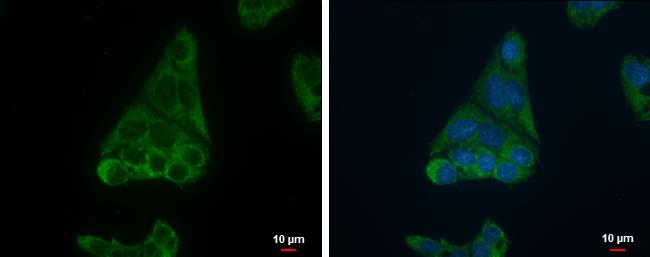 FADS1 Antibody - BSA Free