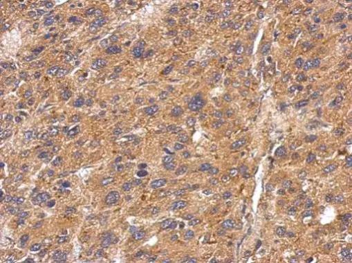 Fetuin Antibody - BSA Free