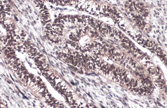 FoxM1 Antibody - BSA Free