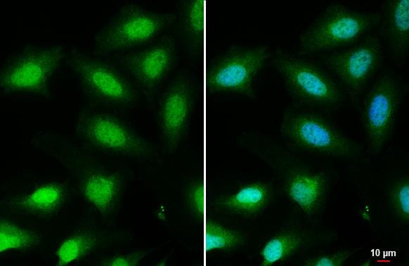 FOXO3 Antibody - BSA Free