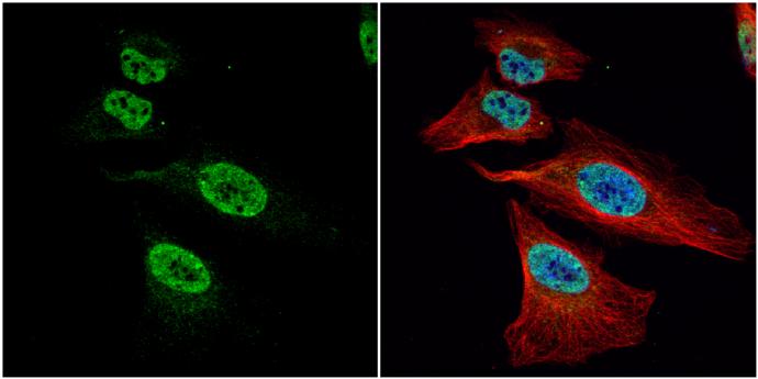 FUBP1 Antibody