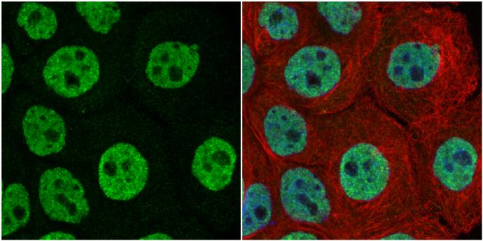 FUBP1 Antibody
