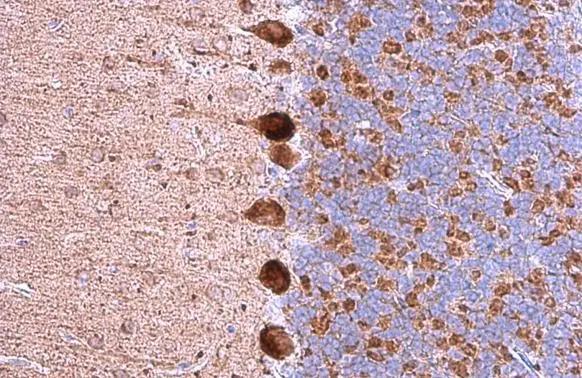 GABA-AR alpha 5 Antibody