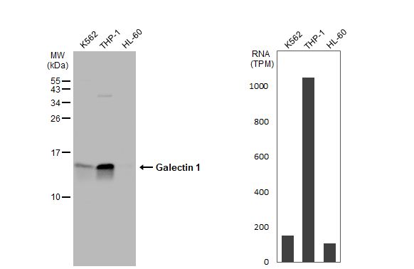 Galectin-1 Antibody