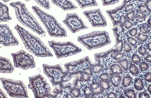GATA-4 Antibody