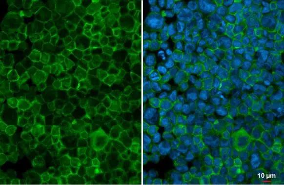 G-CSFR/CD114 Antibody - BSA Free
